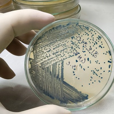 a gloved hand holds a clear dish which contains many blue dots